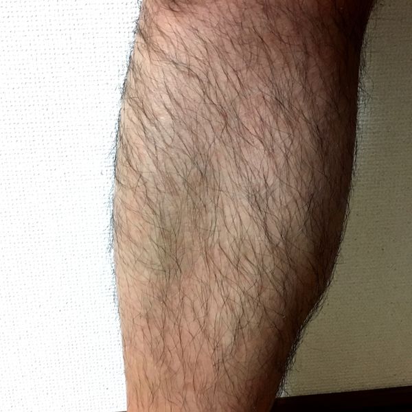 すね毛の脱毛をしたいとお考えでしたらATTENDへお越しください